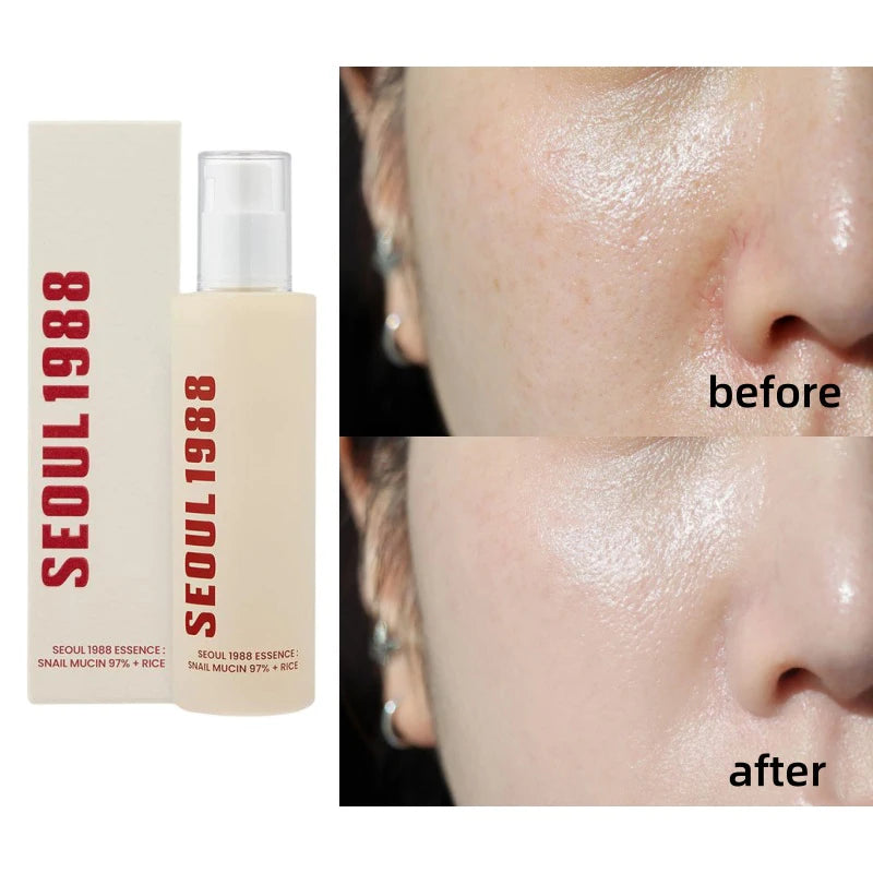 Seoul 1988 Rice Soothing Toner,Cleansing Foam,Retinol Liposome Face Cream Care Serum,Moisturizing sunscreen,Korean Skincare Set