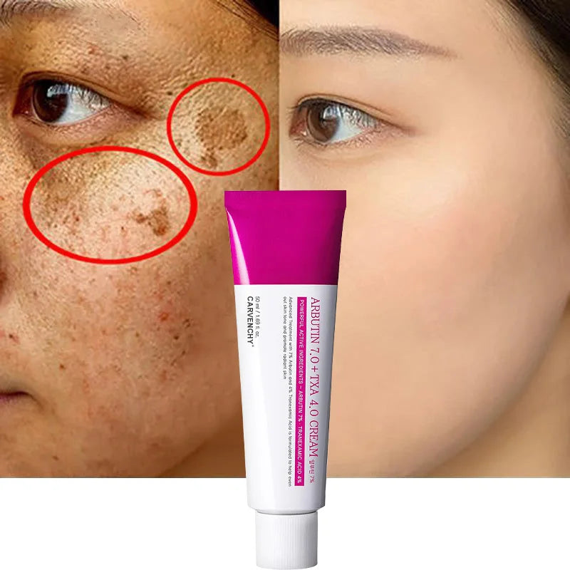 Arbutin Niacinamide Cream Lasting Moisturizing Shrink Pores Brighten Skin Tone Firm Skin Natural Mild Ingredients Facial Care