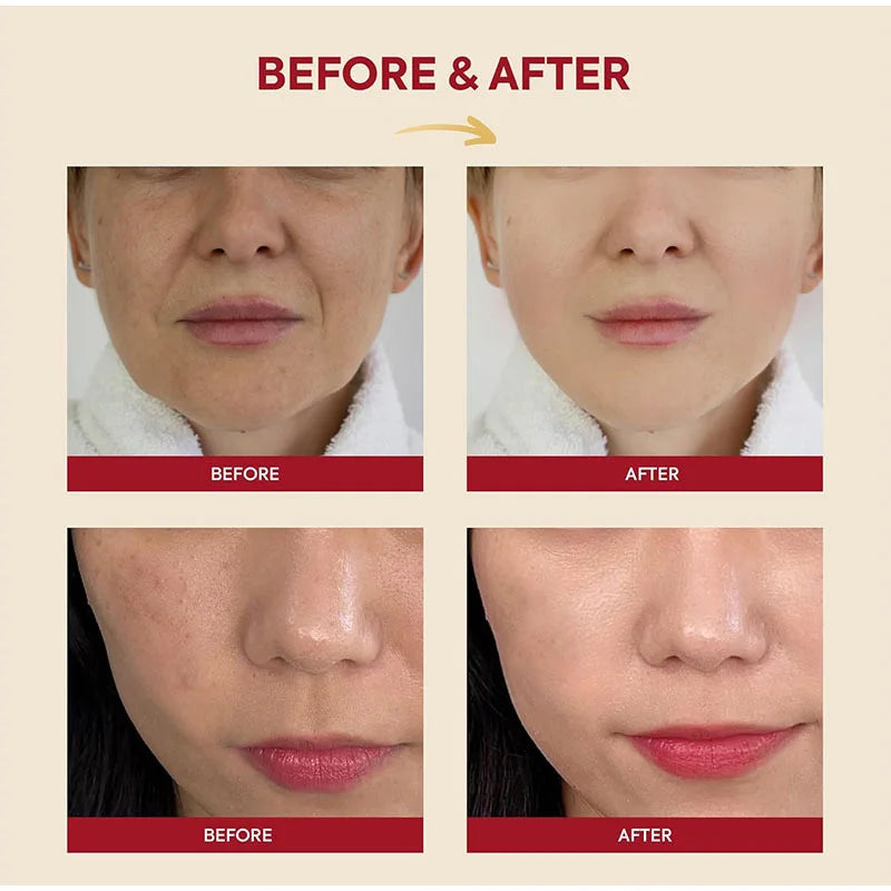 Seoul 1988 Rice Soothing Toner,Cleansing Foam,Retinol Liposome Face Cream Care Serum,Moisturizing sunscreen,Korean Skincare Set