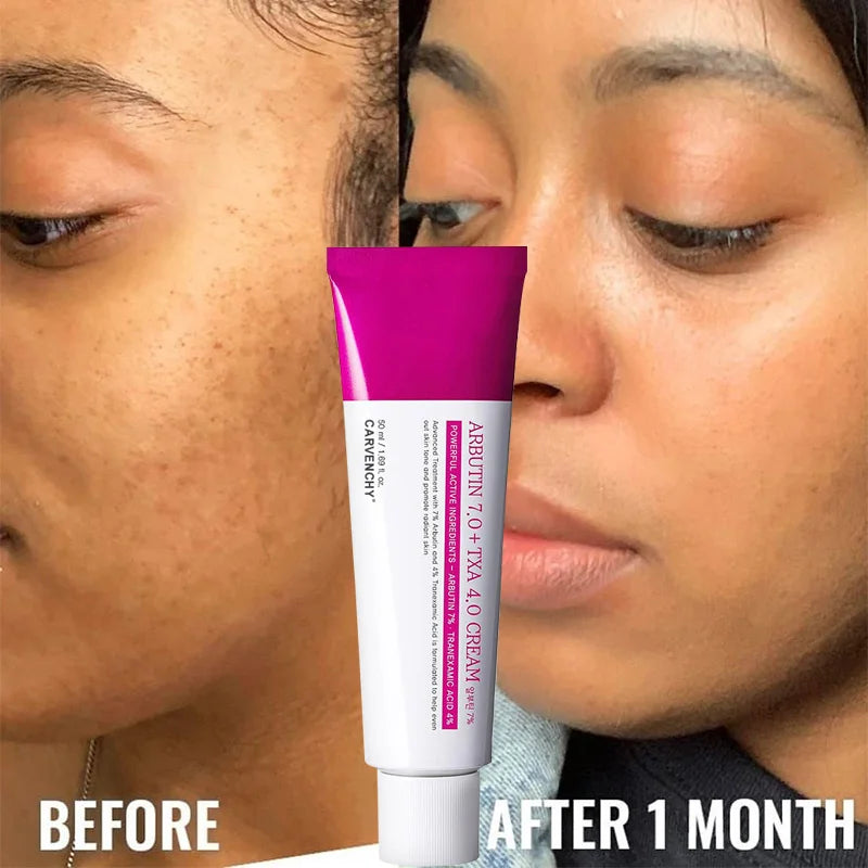 Arbutin Niacinamide Cream Lasting Moisturizing Shrink Pores Brighten Skin Tone Firm Skin Natural Mild Ingredients Facial Care