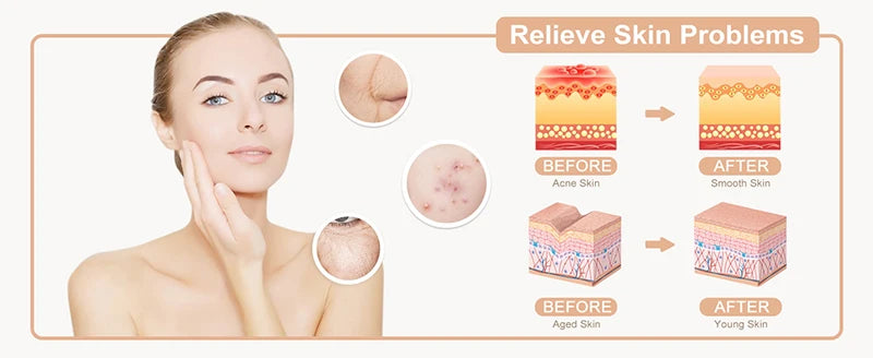 New Orange High Frequency Facial Machine Electrotherapy Wand Neon Argon Tubes Wands Device Face Skin Care  Beauty Tools Home Use