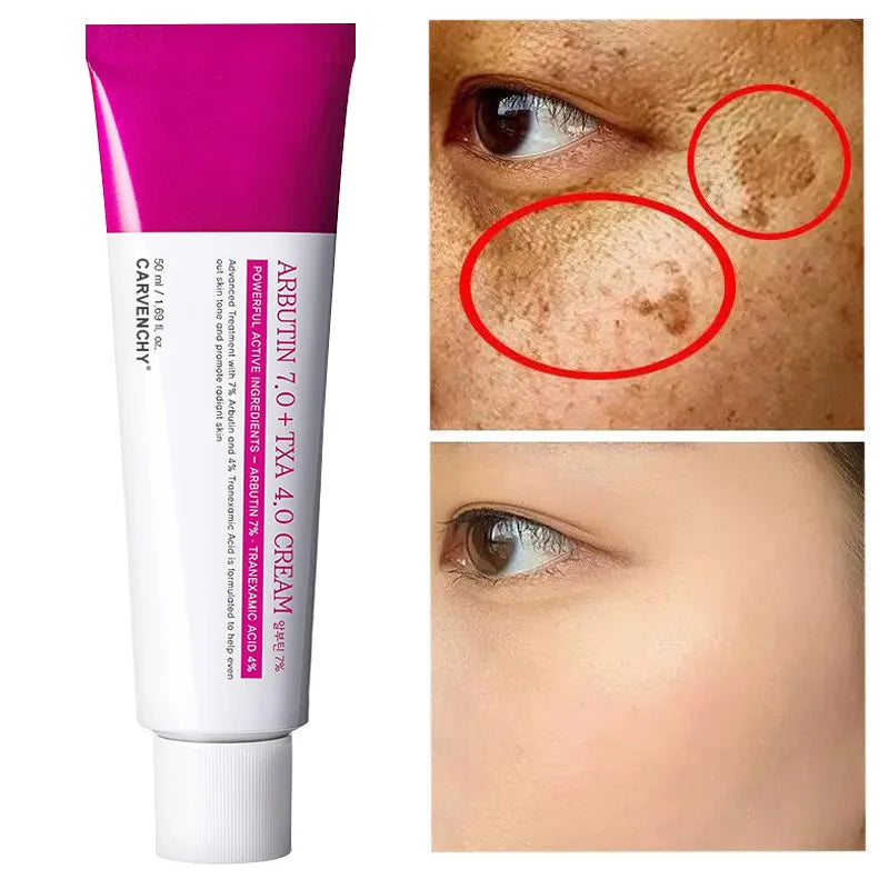 Arbutin Niacinamide Cream Lasting Moisturizing Shrink Pores Brighten Skin Tone Firm Skin Natural Mild Ingredients Facial Care