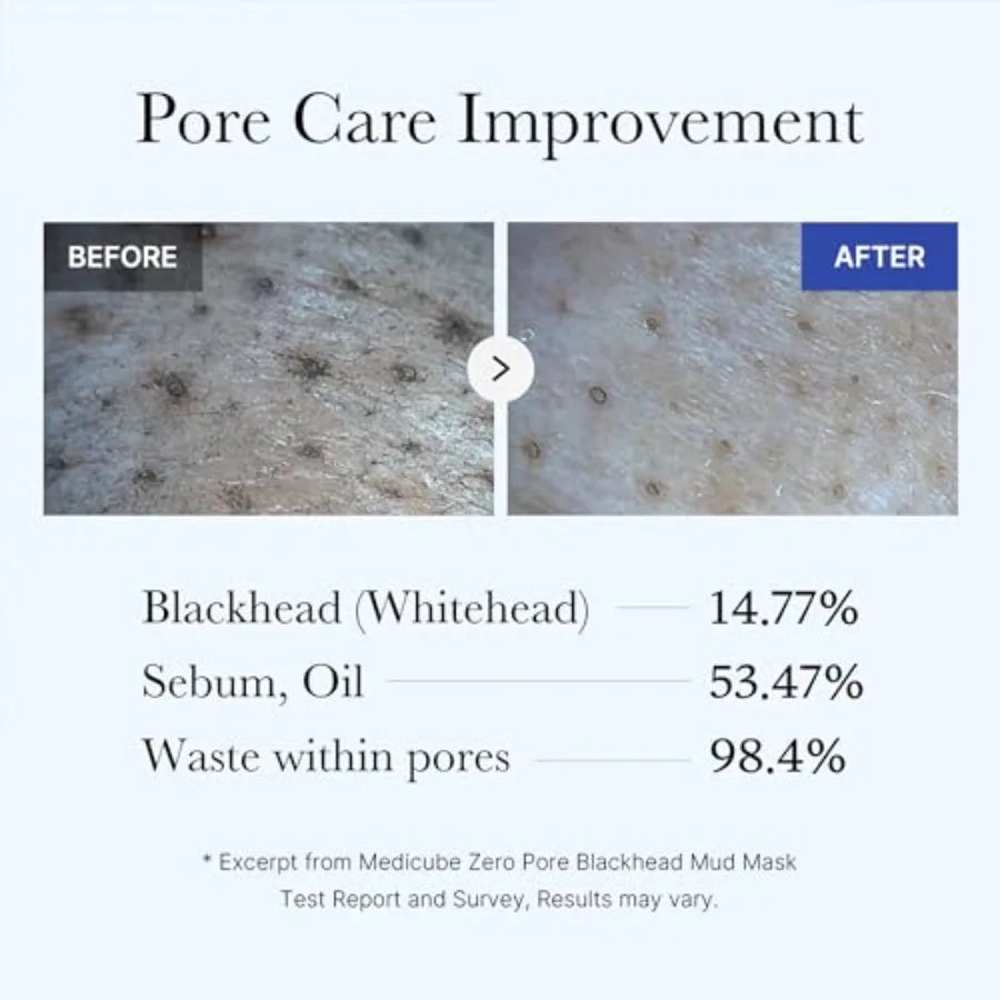 Zero Pore Black Mud Facial Mask Skin Cooling Pore Tightening 3 Minute Quick Dry Formula with AHA BHA PHA and PorePurifying Clay