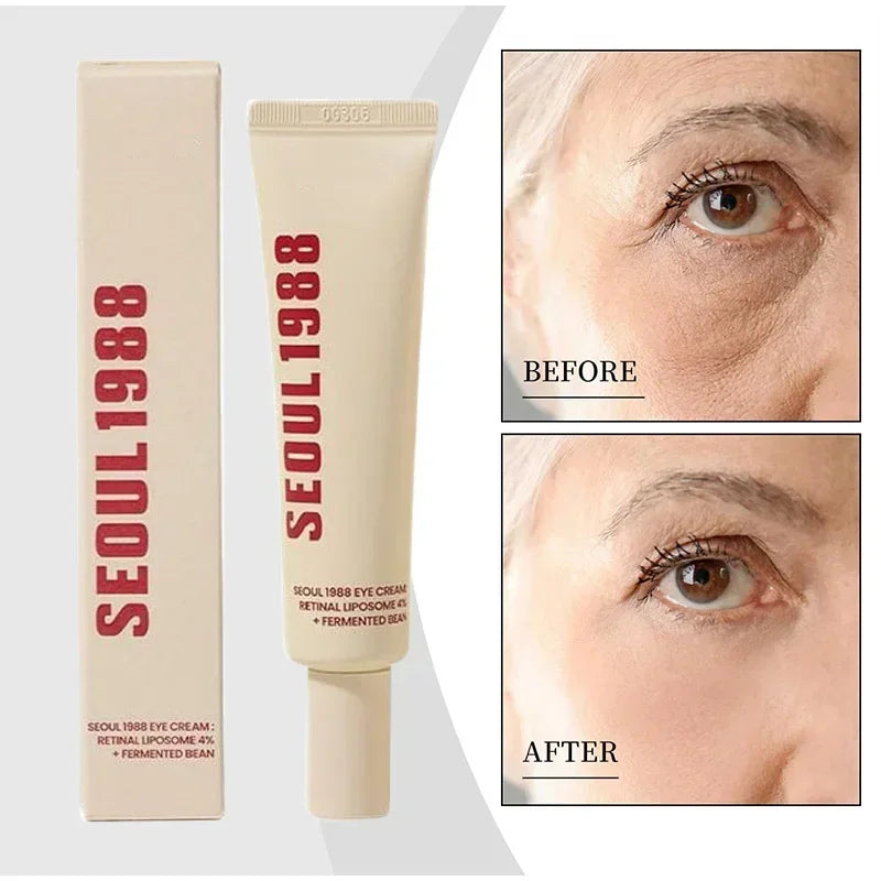 Seoul 1988 Rice Soothing Toner,Cleansing Foam,Retinol Liposome Face Cream Care Serum,Moisturizing sunscreen,Korean Skincare Set