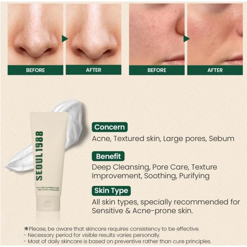 Seoul 1988 Rice Soothing Toner,Cleansing Foam,Retinol Liposome Face Cream Care Serum,Moisturizing sunscreen,Korean Skincare Set