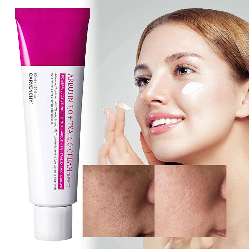 Arbutin Niacinamide Cream Lasting Moisturizing Shrink Pores Brighten Skin Tone Firm Skin Natural Mild Ingredients Facial Care