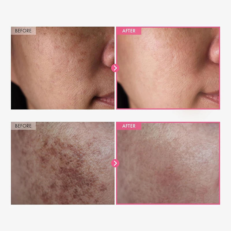 Arbutin Niacinamide Cream Lasting Moisturizing Shrink Pores Brighten Skin Tone Firm Skin Natural Mild Ingredients Facial Care