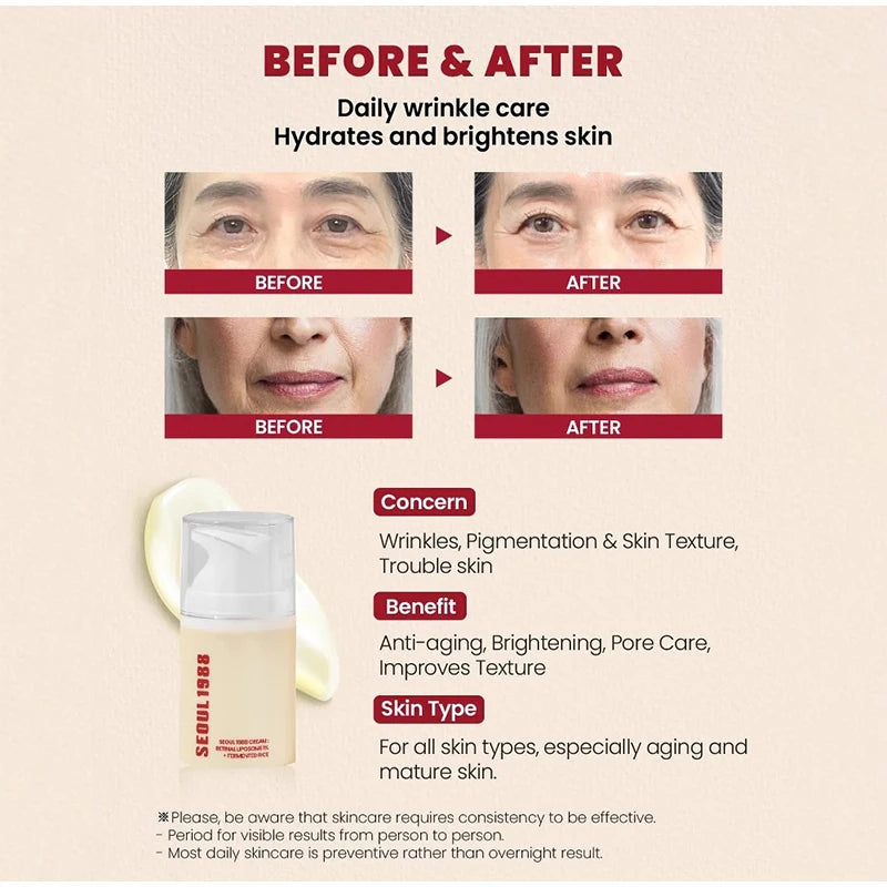 Seoul 1988 Rice Soothing Toner,Cleansing Foam,Retinol Liposome Face Cream Care Serum,Moisturizing sunscreen,Korean Skincare Set