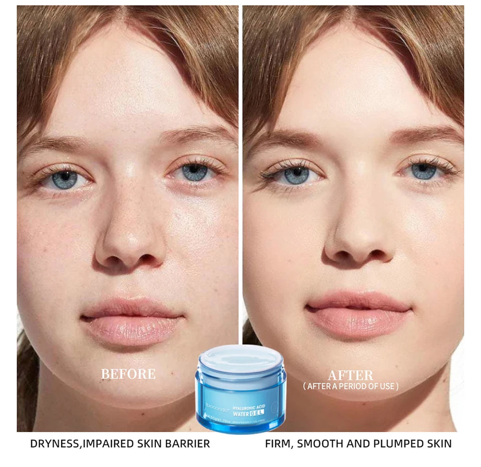 Hyaluronic Acid Gel Cream Hydrating Face Moisturizer For Hydrate&Smooth Extra-Dry Skin Nourishing Improve Dryness Facial Lotion