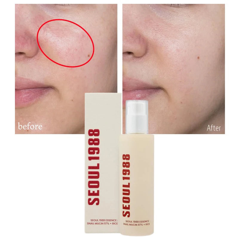 Seoul 1988 Rice Soothing Toner,Cleansing Foam,Retinol Liposome Face Cream Care Serum,Moisturizing sunscreen,Korean Skincare Set