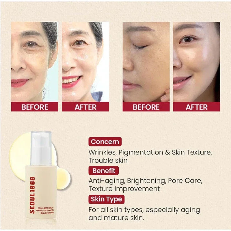 Seoul 1988 Rice Soothing Toner,Cleansing Foam,Retinol Liposome Face Cream Care Serum,Moisturizing sunscreen,Korean Skincare Set